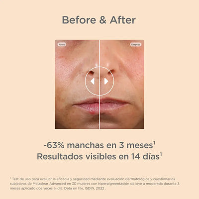 ISDINCEUTICS  Melaclear Advanced